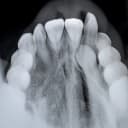 Occlusal (عکس از سطح کامل دندان‌ها)